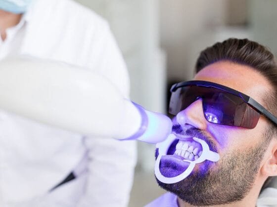 Cuci Gigi Apa yang Anda Perlu Tahu